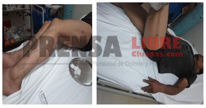 HIEREN A UNA PERSONA EN LOS L&Iacute;MITES EN CONFLICTO ALDAMA-CHENALH&Oacute;