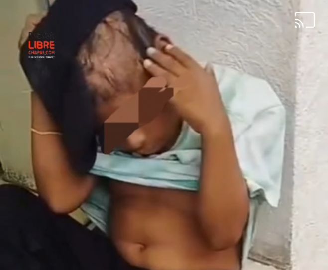 Menor sufre maltrato familiar en Ocosingo