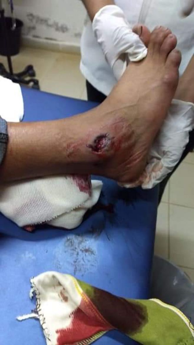 Fuerzas armadas huyen de Aldama dejando un civil herido