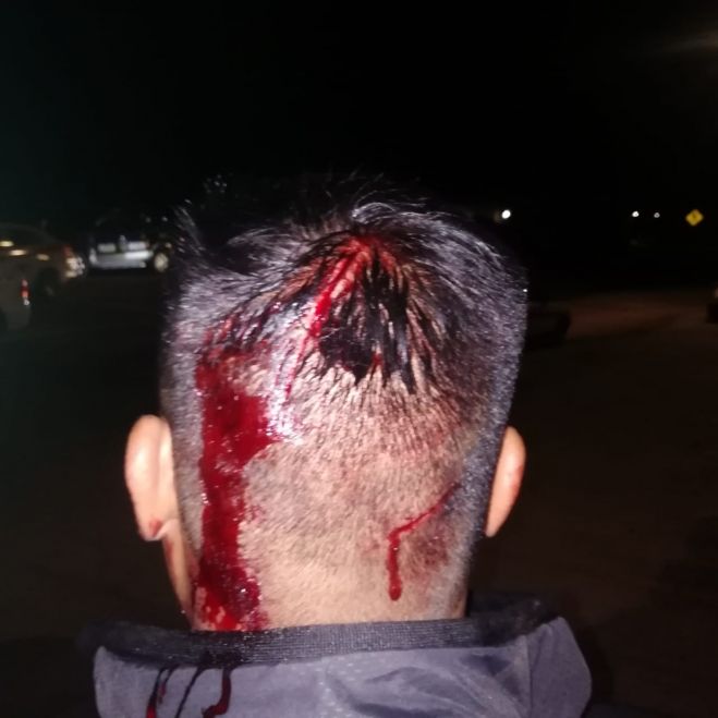 ASALTAN Y AGREDEN A MACHETAZOS A TAXISTAS