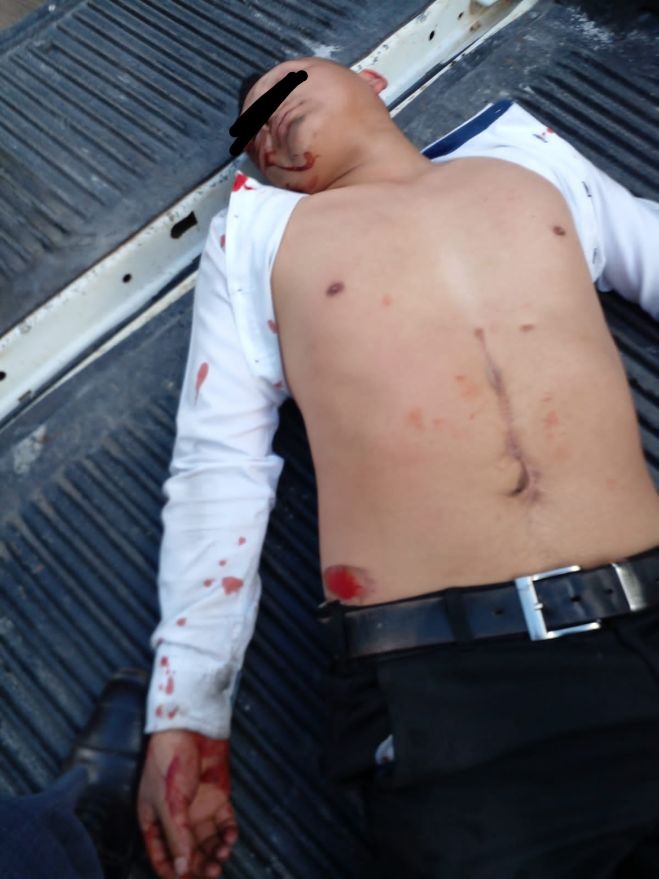 Derrapa en su motocicleta y queda grave